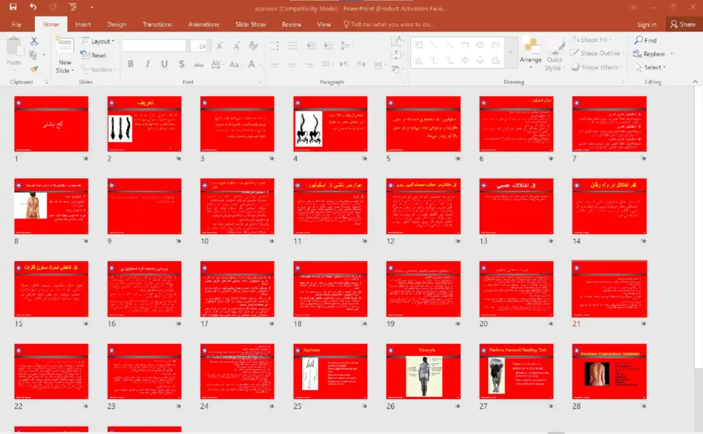 پاورپوینت کج پشتی {اسکولیوز SCOLIOSIS}
